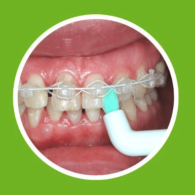 APACARE SONIC 3D sensitive vieno danties šepetėlio galvutės